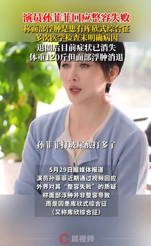 演员孙菲菲回应整容失败！称容貌变化是因为患“库欣式综合征”